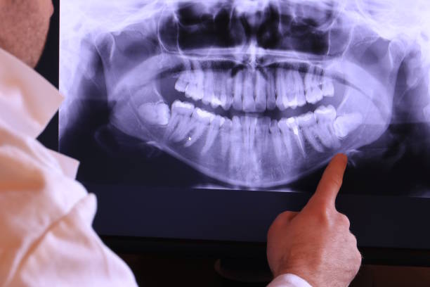 Best Mobile Emergency Dentist in San Rlos, CA