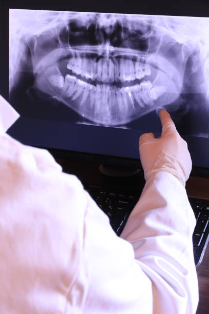 Best Weekend Emergency Dentist in San Rlos, CA