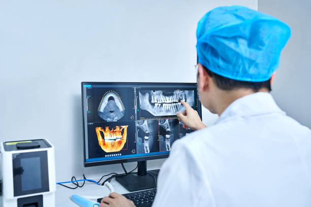 Best Emergency Dentist for Knocked-Out Tooth in San Rlos, CA