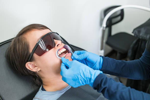 Best Emergency Root Canal Treatment in San Rlos, CA
