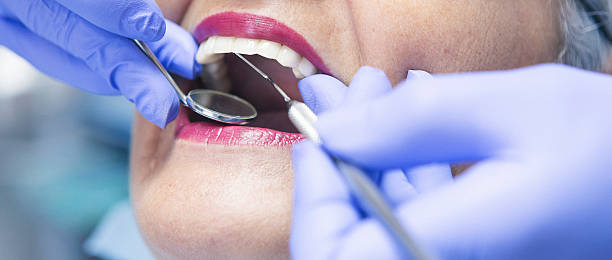Best Emergency Cosmetic Dentistry in San Rlos, CA